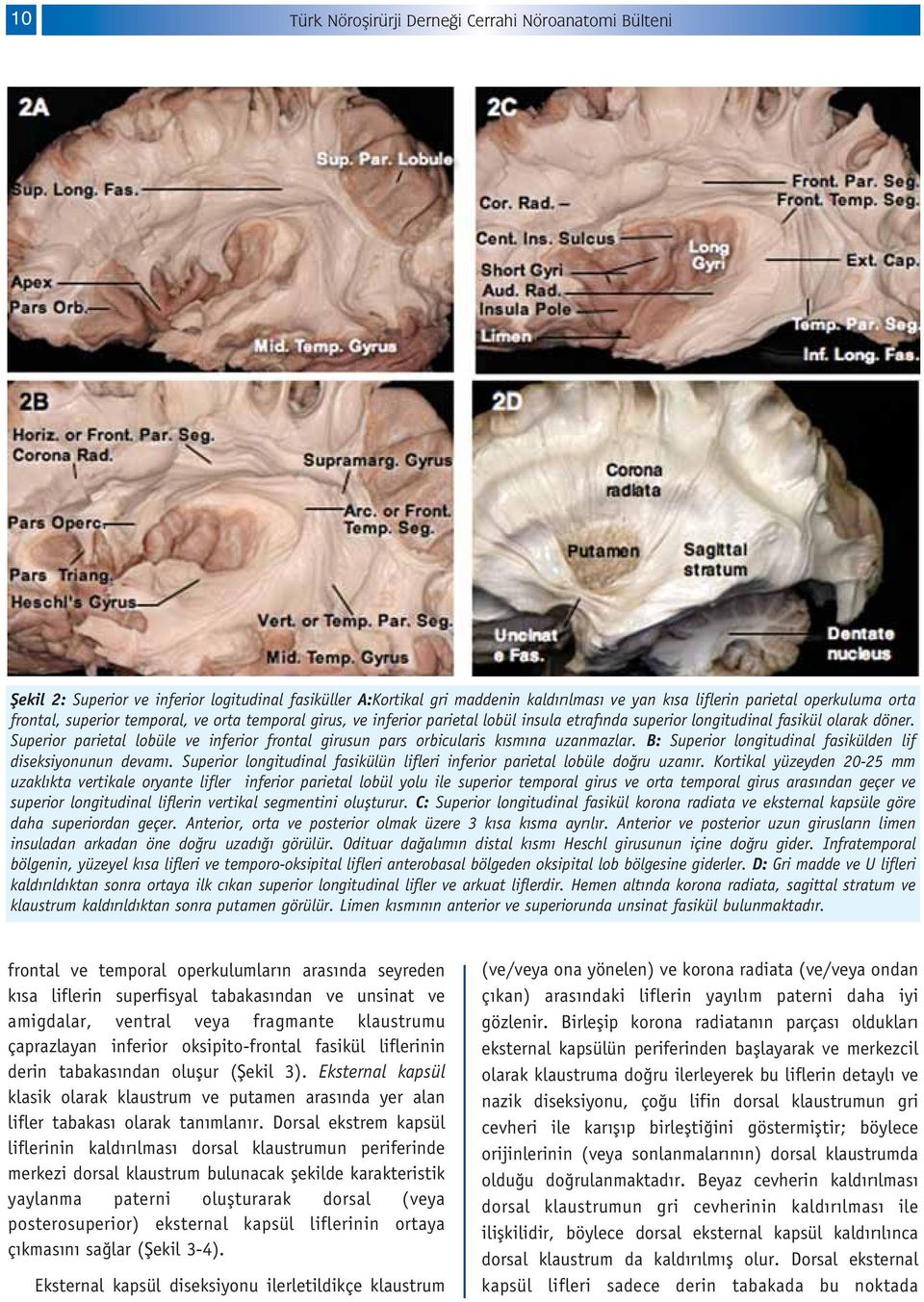 Superior parietal lobüle ve inferior frontal girusun pars orbicularis k sm na uzanmazlar. B: Superior longitudinal fasikülden lif diseksiyonunun devam.