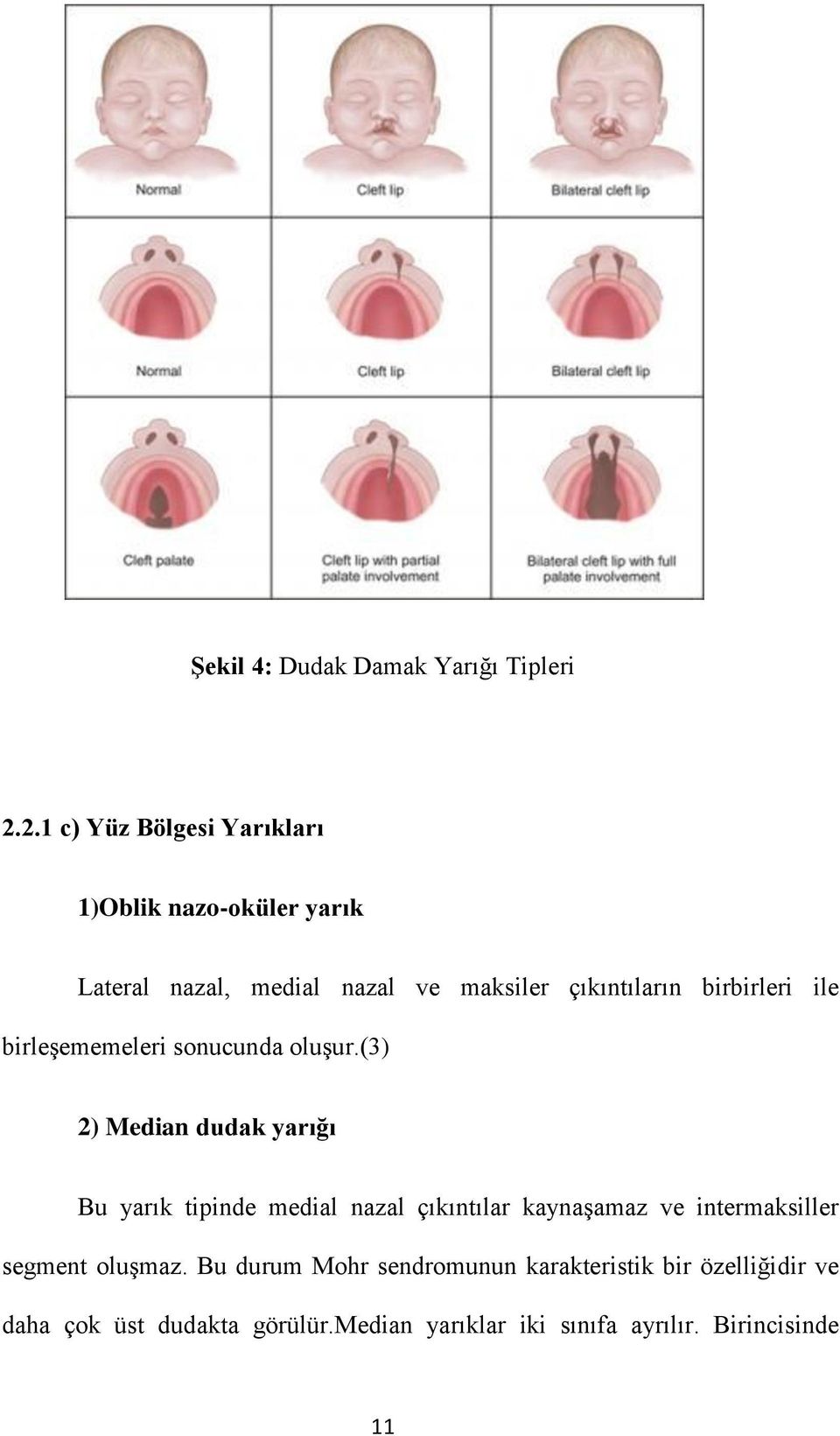 birbirleri ile birleşememeleri sonucunda oluşur.