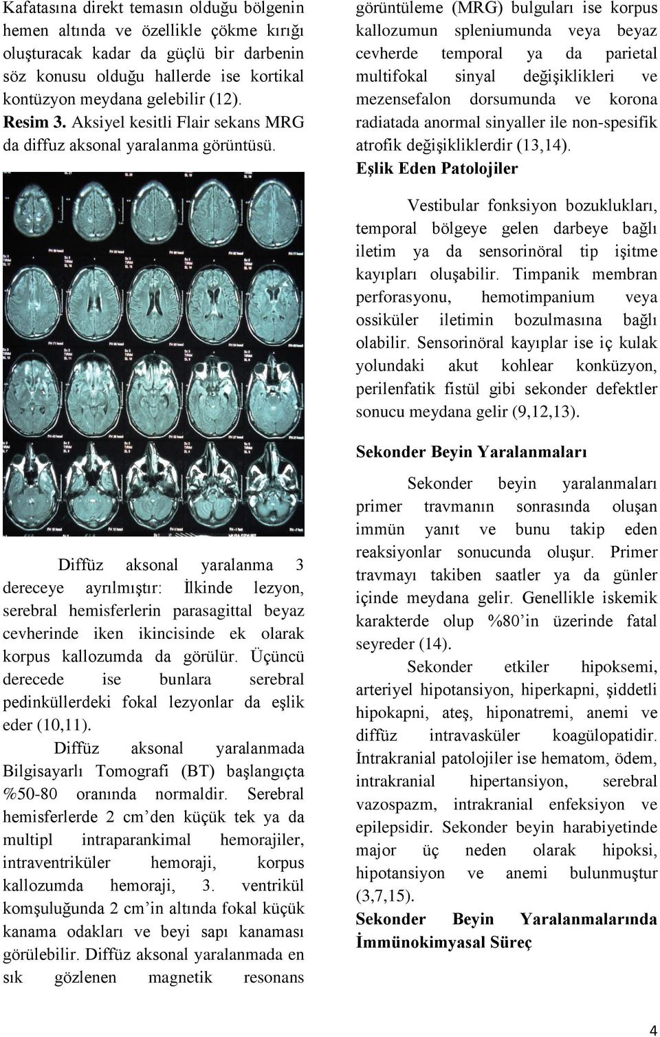 görüntüleme (MRG) bulguları ise korpus kallozumun spleniumunda veya beyaz cevherde temporal ya da parietal multifokal sinyal değişiklikleri ve mezensefalon dorsumunda ve korona radiatada anormal