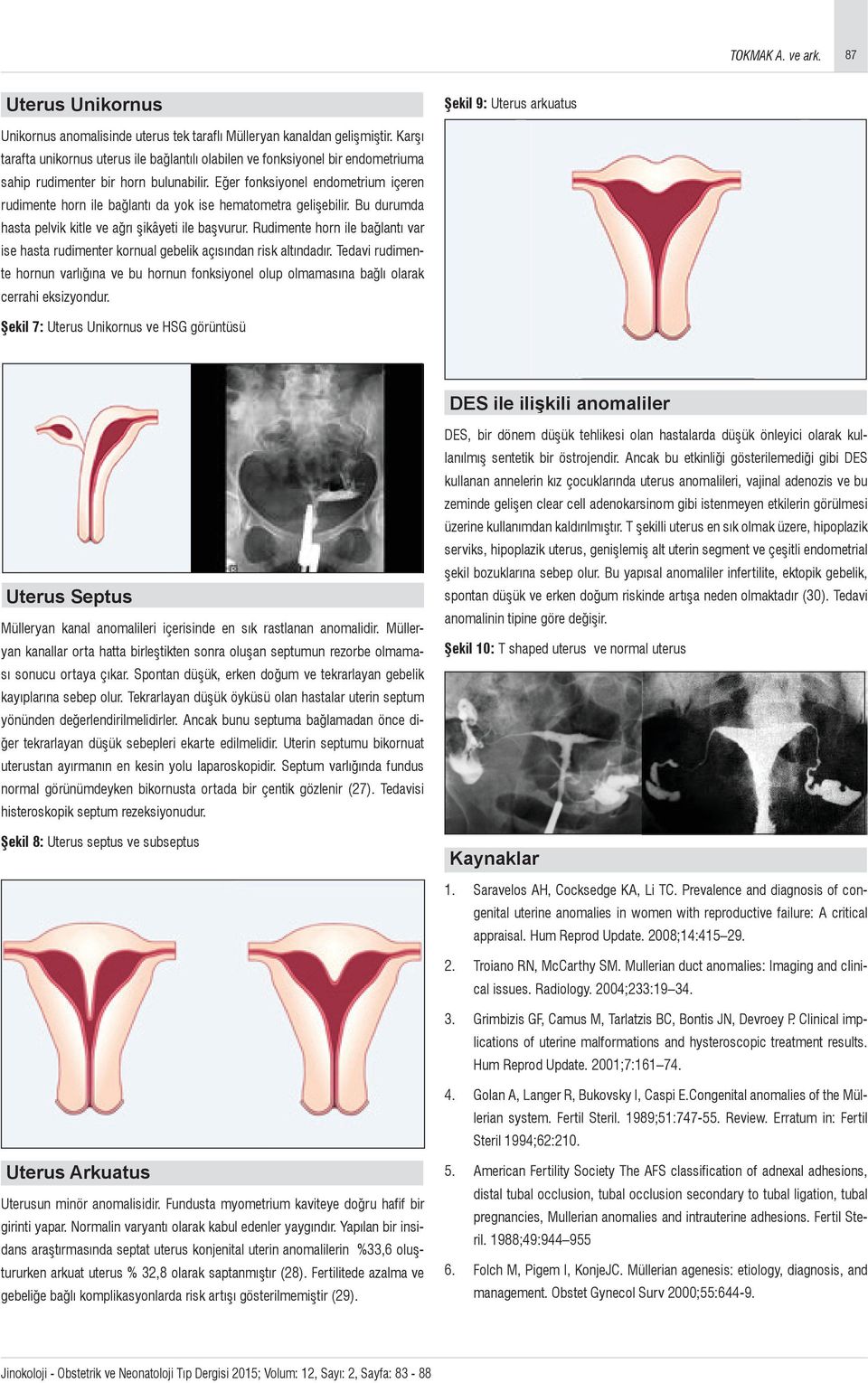 Eğer fonksiyonel endometrium içeren rudimente horn ile bağlantı da yok ise hematometra gelişebilir. Bu durumda hasta pelvik kitle ve ağrı şikâyeti ile başvurur.