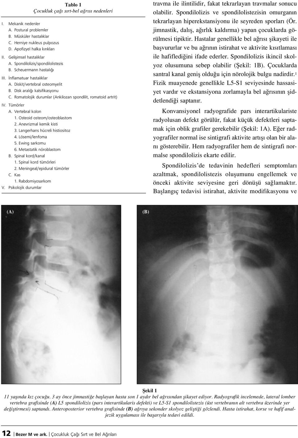 Romatolojik durumlar (Ankilozan spondilit, romatoid artrit) IV. Tümörler A. Vertebral kolon 1. Osteoid osteom/osteoblastom 2. Anevrizmal kemik kisti 3. Langerhans hücreli histiositoz 4.