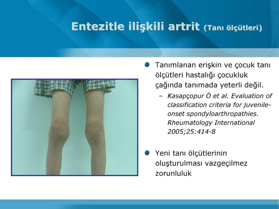 Evaluation of classification criteria for juvenileonset spondyloarthropathies.