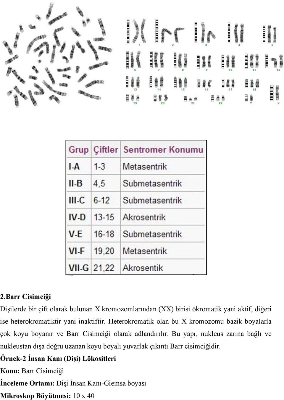 Heterokromatik olan bu X kromozomu bazik boyalarla çok koyu boyanır ve Barr Cisimciği olarak adlandırılır.