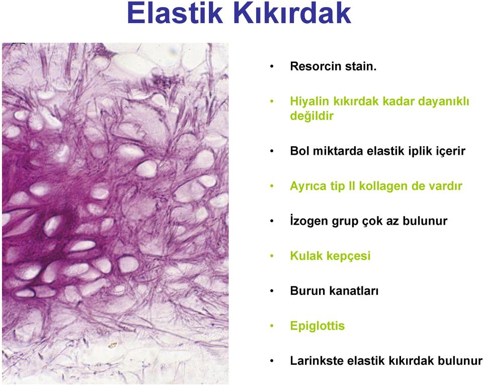 elastik iplik içerir Ayrıca tip II kollagen de vardır İzogen