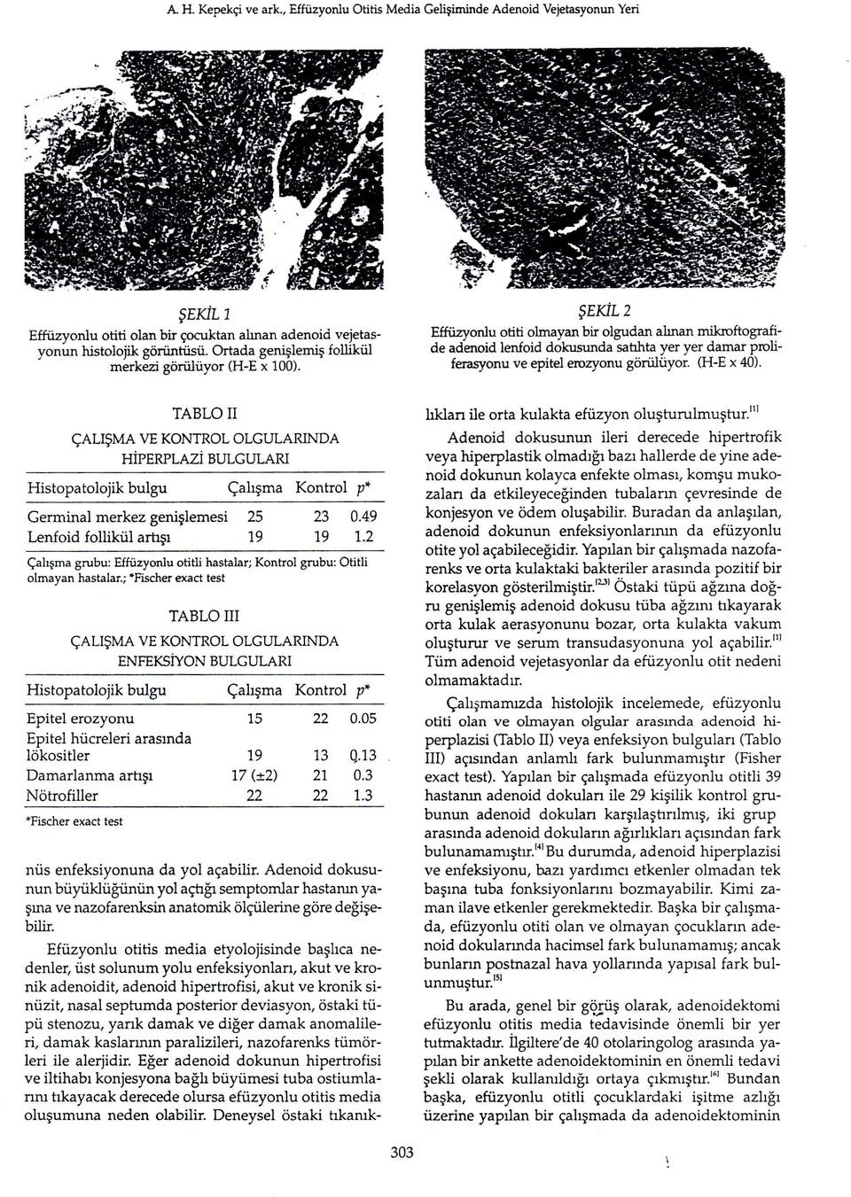 TABLO il ÇALIŞMA VE KONTROL OLGULARINDA HİPERPLAZİ BULGULARI Histopatolojik bulgu Çalışma Kontrol p* Germinal merkez genişlemesi 25 Lenfoid follikül artışı 19 23 0.49 19 1.