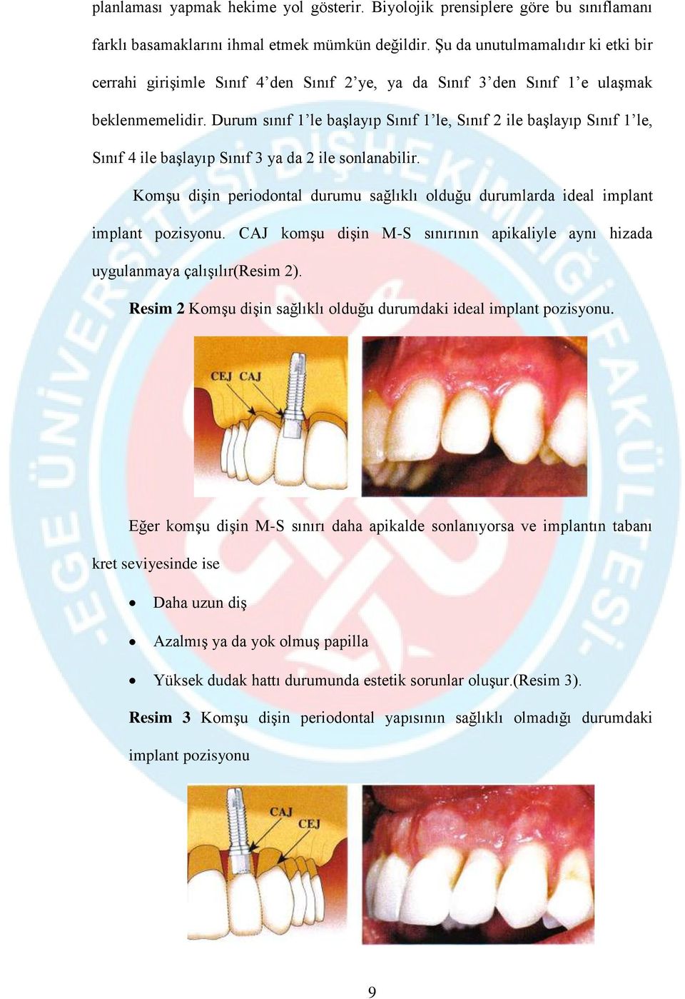 Durum sınıf 1 le başlayıp Sınıf 1 le, Sınıf 2 ile başlayıp Sınıf 1 le, Sınıf 4 ile başlayıp Sınıf 3 ya da 2 ile sonlanabilir.