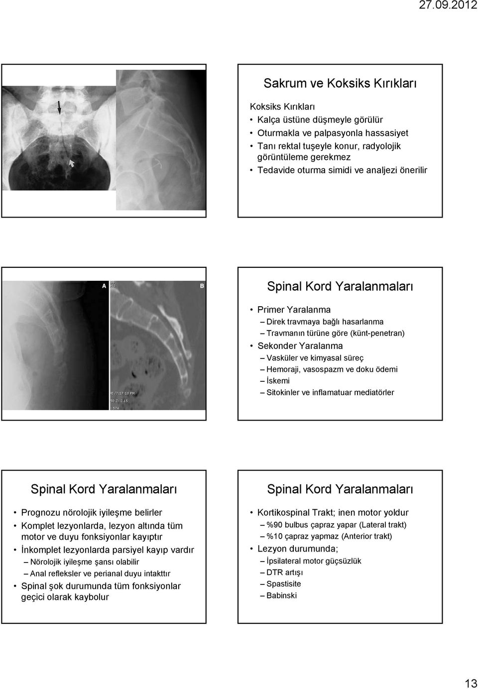 doku ödemi İskemi Sitokinler ve inflamatuar mediatörler Spinal Kord Yaralanmaları Prognozu nörolojik iyileşme belirler Komplet lezyonlarda, lezyon altında tüm motor ve duyu fonksiyonlar kayıptır