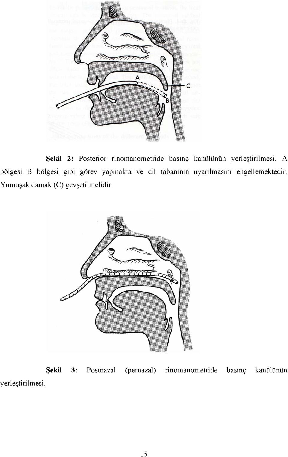 uyarılmasını engellemektedir. Yumuşak damak (C) gevşetilmelidir.