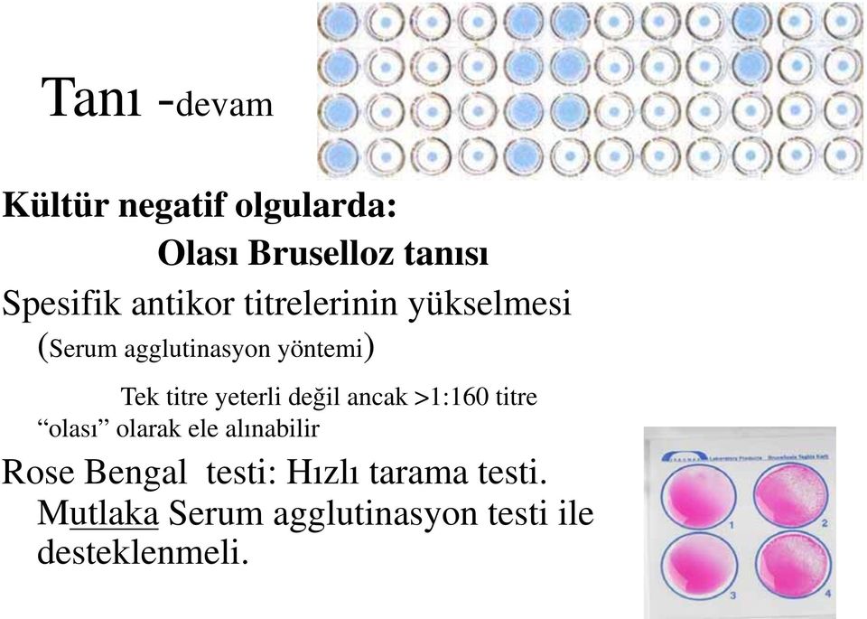 yeterli değil ancak >1:160 titre olası olarak ele alınabilir Rose Bengal