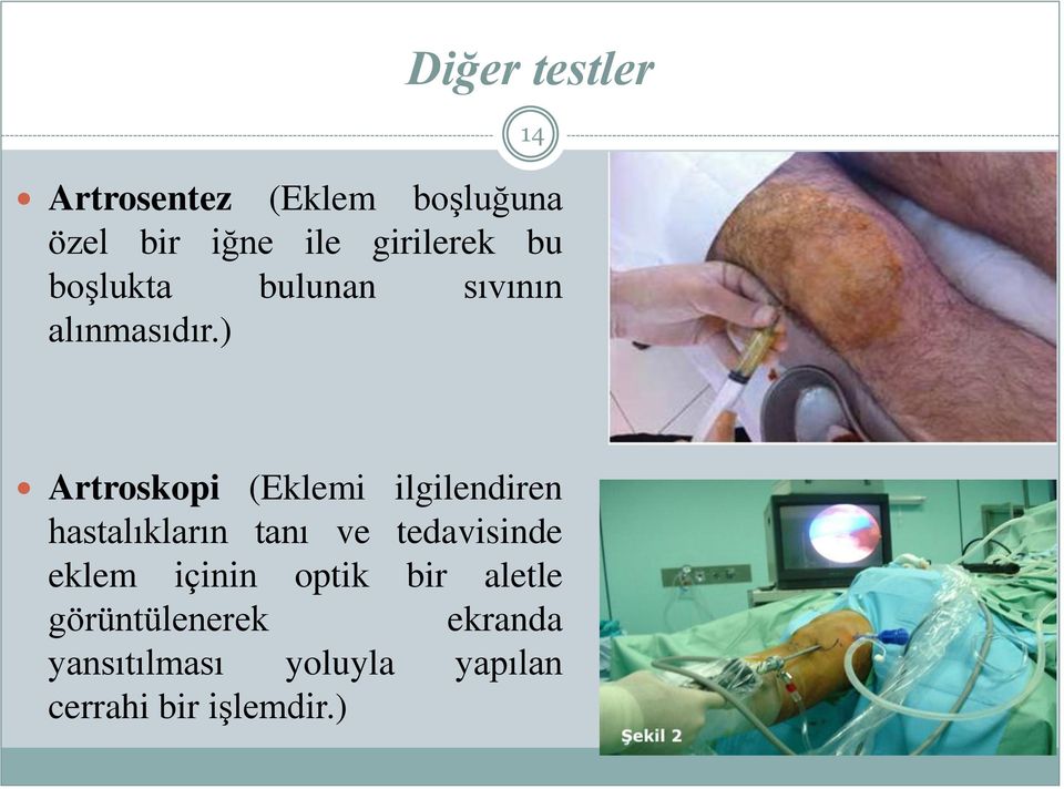 ) Artroskopi (Eklemi ilgilendiren hastalıkların tanı ve tedavisinde