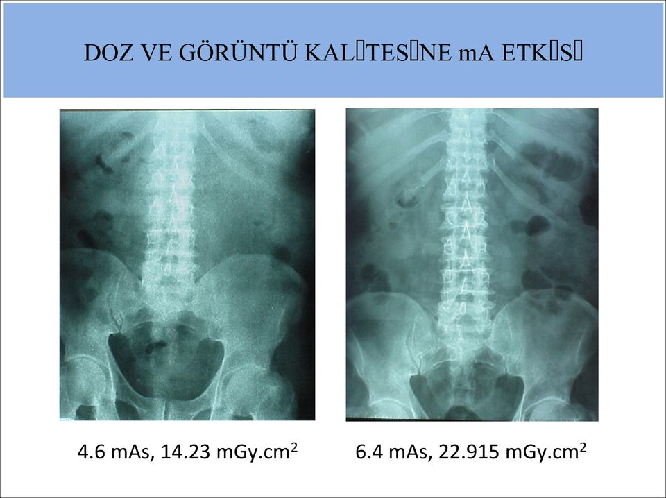 4.6 mas, 14.23 mgy.