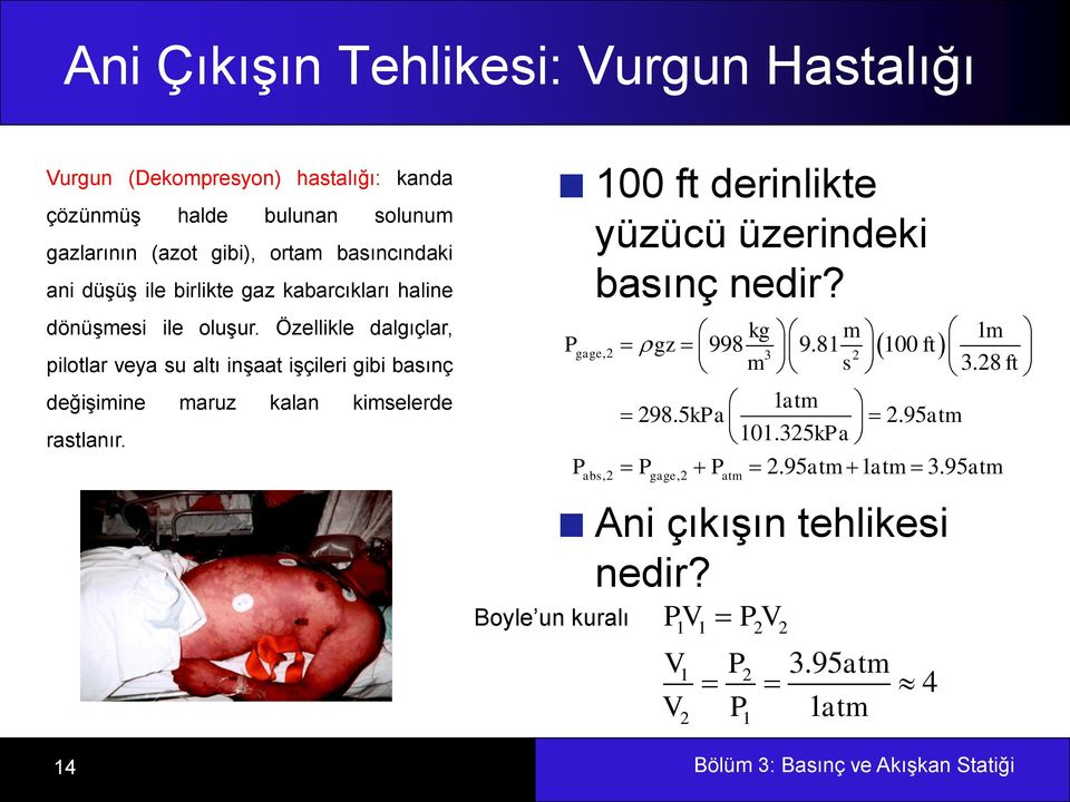 Özellikle dalgıçlar, pilotlar veya su altı inşaat işçileri gibi basınç değişimine maruz kalan kimselerde rastlanır.