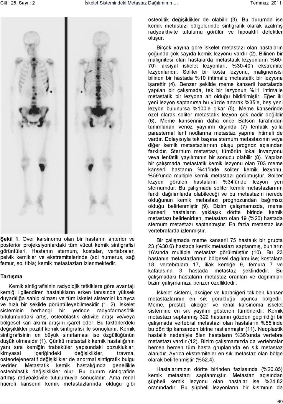 Tartışma Kemik sintigrafisinin radyolojik tetkiklere göre avantajı kemiği ilgilendiren hastalıkların erken tanısında yüksek duyarlılığa sahip olması ve tüm iskelet sistemini kolayca ve hızlı bir
