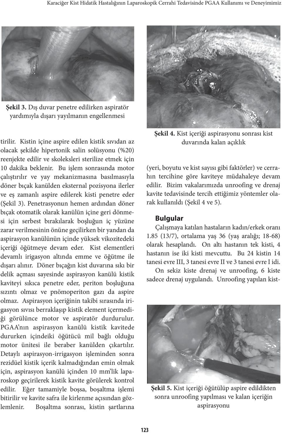 Bu işlem sonrasında motor çalıştırılır ve yay mekanizmasına basılmasıyla döner bıçak kanülden eksternal pozisyona ilerler ve eş zamanlı aspire edilerek kisti penetre eder (Şekil 3).