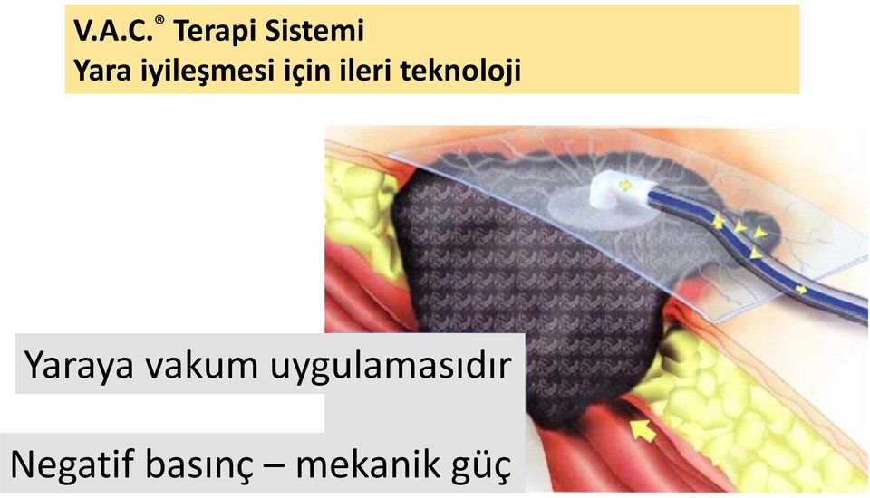 iyileşmesi için ileri