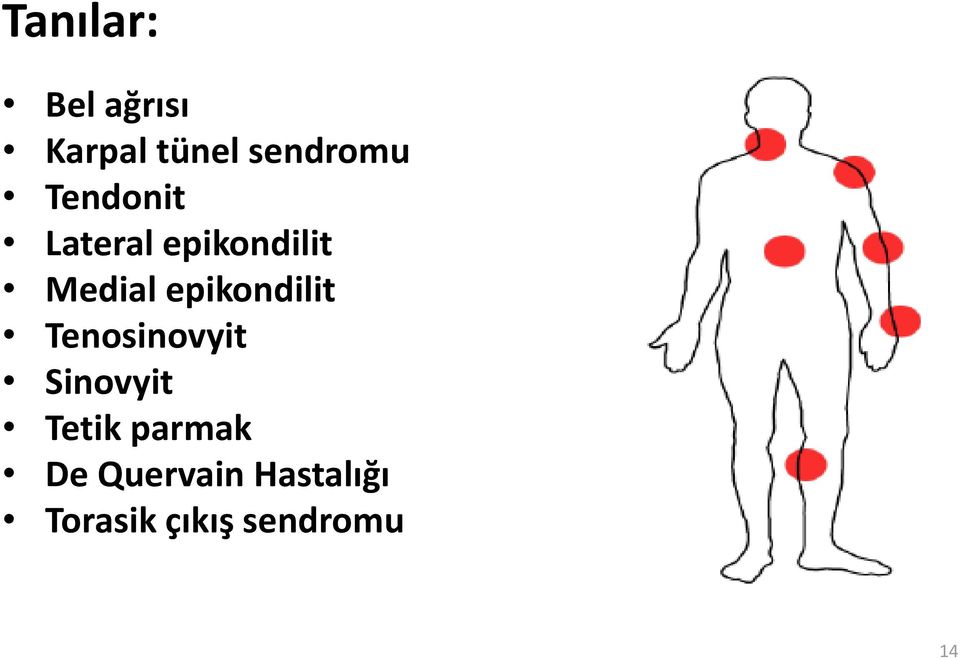 epikondilit Tenosinovyit Sinovyit Tetik