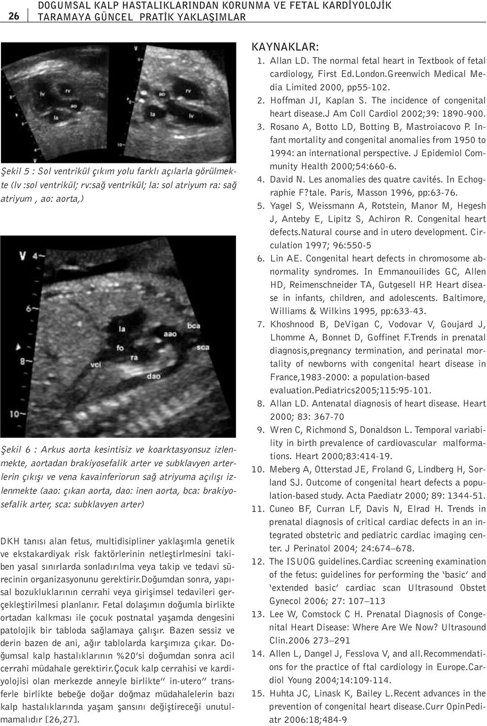 atriyuma aç l fl izlenmekte (aao: ç kan aorta, dao: inen aorta, bca: brakiyosefalik arter, sca: subklavyen arter) DKH tan s alan fetus, multidisipliner yaklafl mla genetik ve ekstakardiyak risk