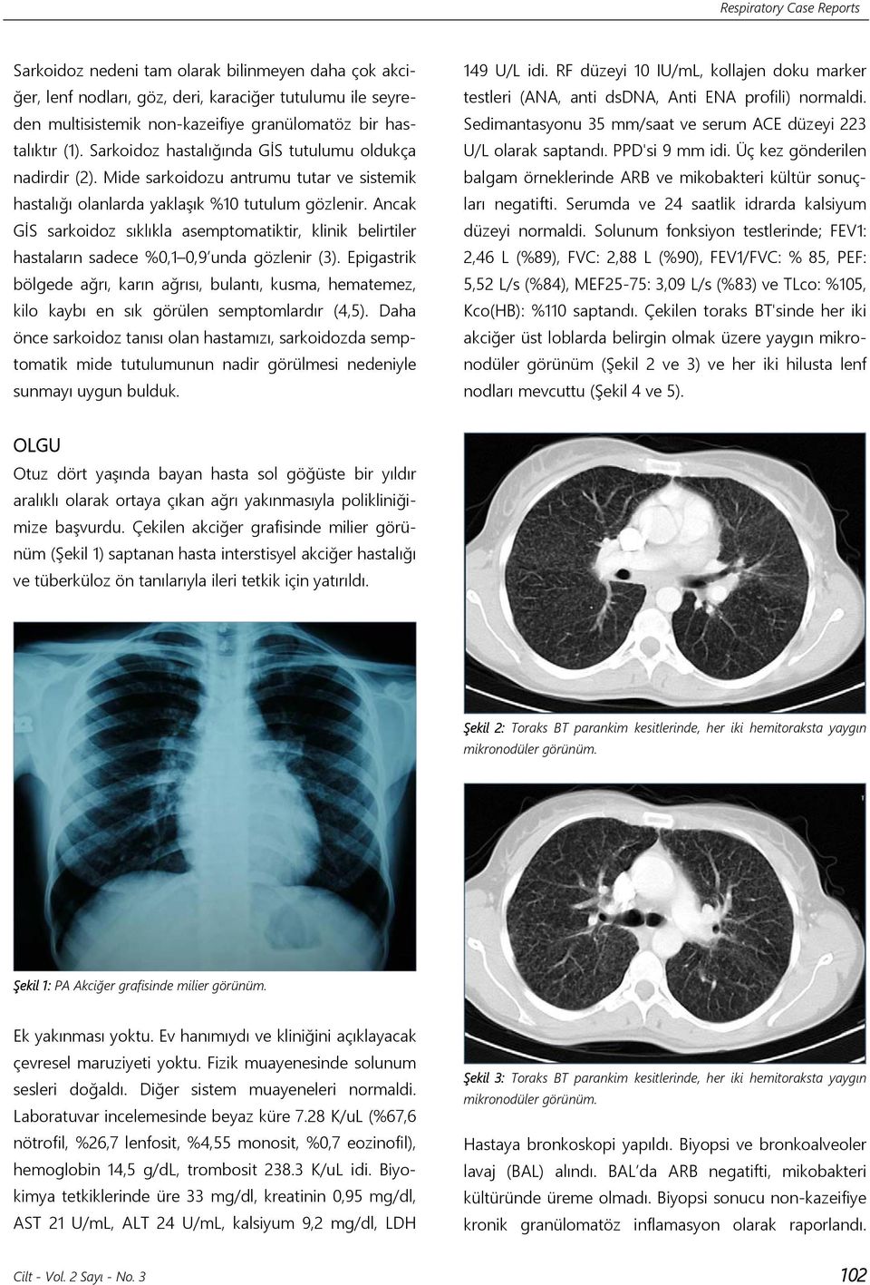 Ancak GİS sarkoidoz sıklıkla asemptomatiktir, klinik belirtiler hastaların sadece %0,1 0,9 unda gözlenir (3).