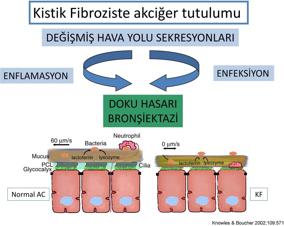 ENFLAMASYON ENFEKSİYON DOKU HASARI