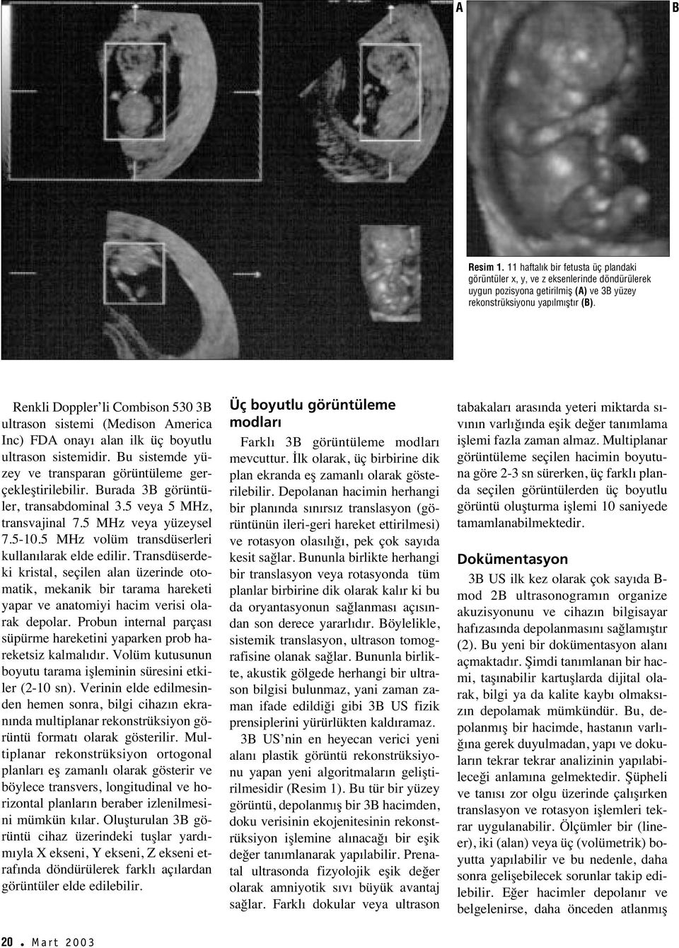 Burada 3B görüntüler, transabdominal 3.5 veya 5 MHz, transvajinal 7.5 MHz veya yüzeysel 7.5-10.5 MHz volüm transdüserleri kullan larak elde edilir.