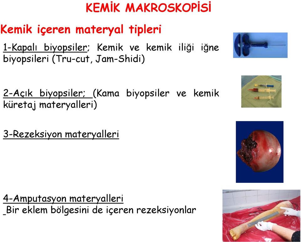 biyopsiler; (Kama biyopsiler ve kemik küretaj materyalleri) 3-Rezeksiyon