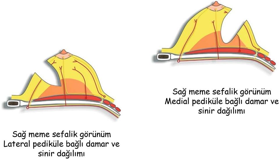 dağılımı Sağ meme sefalik görünüm