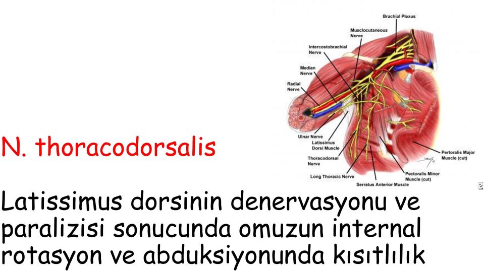 paralizisi sonucunda omuzun