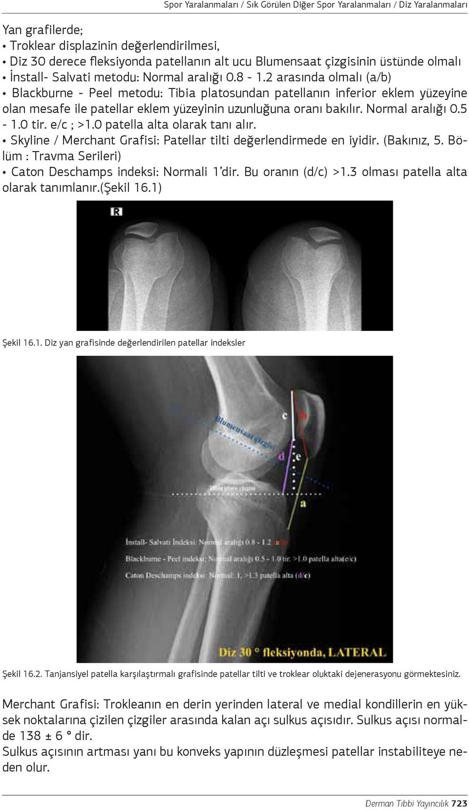 e/c ; >1.0 patella alta olarak tanı alır. Skyline / Merchant Grafisi: Patellar tilti değerlendirmede en iyidir. (Bakınız, 5. Bölüm : Travma Serileri) Caton Deschamps indeksi: Normali 1 dir.