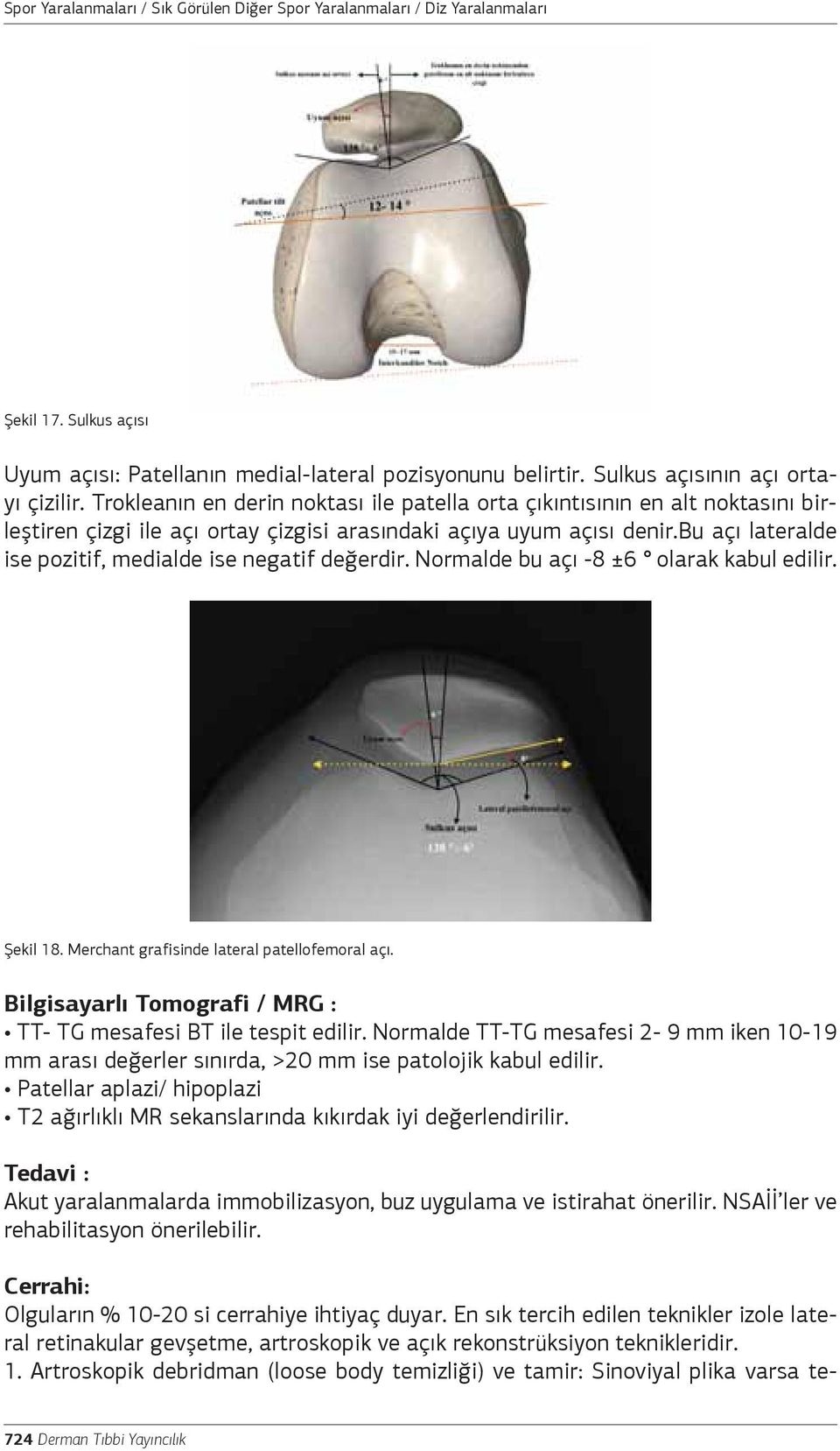 bu açı lateralde ise pozitif, medialde ise negatif değerdir. Normalde bu açı -8 ±6 olarak kabul edilir. Şekil 18. Merchant grafisinde lateral patellofemoral açı.