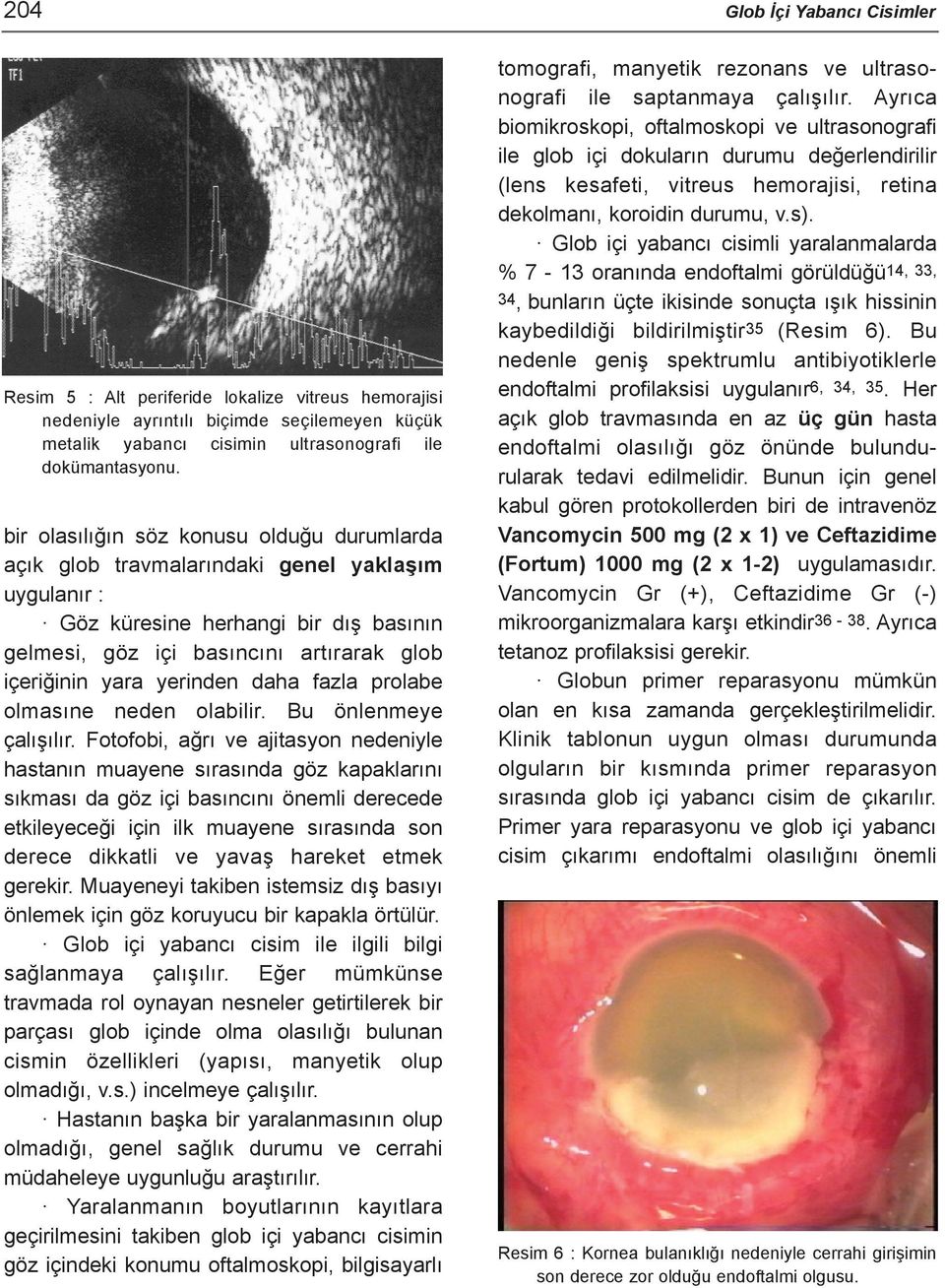 yerinden daha fazla prolabe olmasýne neden olabilir. Bu önlenmeye çalýþýlýr.