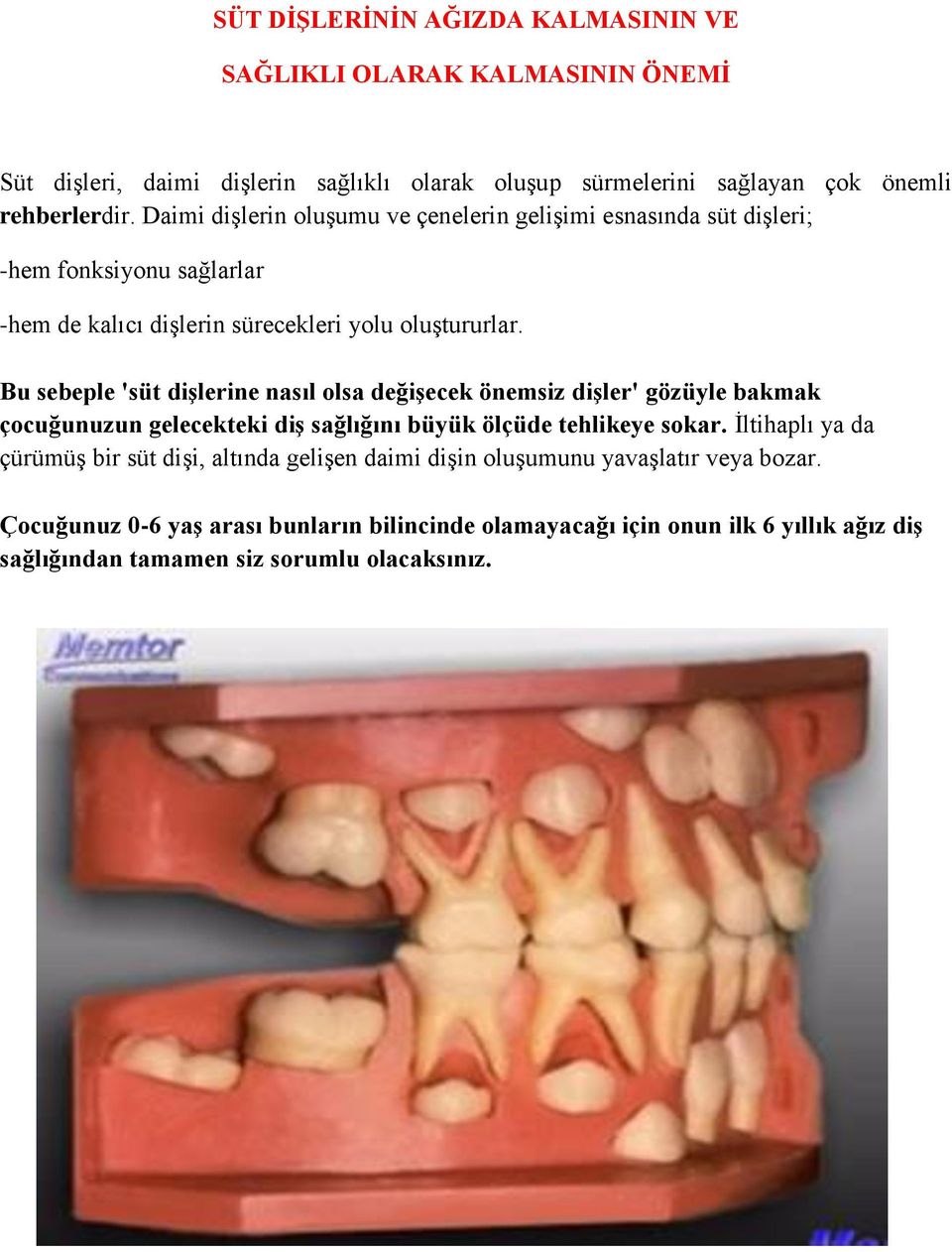 Bu sebeple 'süt dişlerine nasıl olsa değişecek önemsiz dişler' gözüyle bakmak çocuğunuzun gelecekteki diş sağlığını büyük ölçüde tehlikeye sokar.