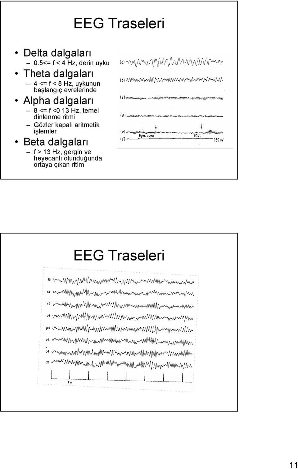 evrelerinde Alpha dalgaları 8 <= f <0 13 Hz, temel dinlenme ritmi Gözler