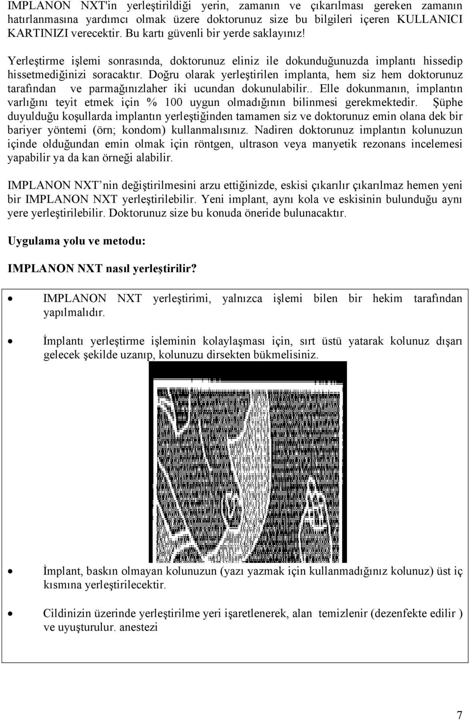 Doğru olarak yerleştirilen implanta, hem siz hem doktorunuz tarafından ve parmağınızlaher iki ucundan dokunulabilir.