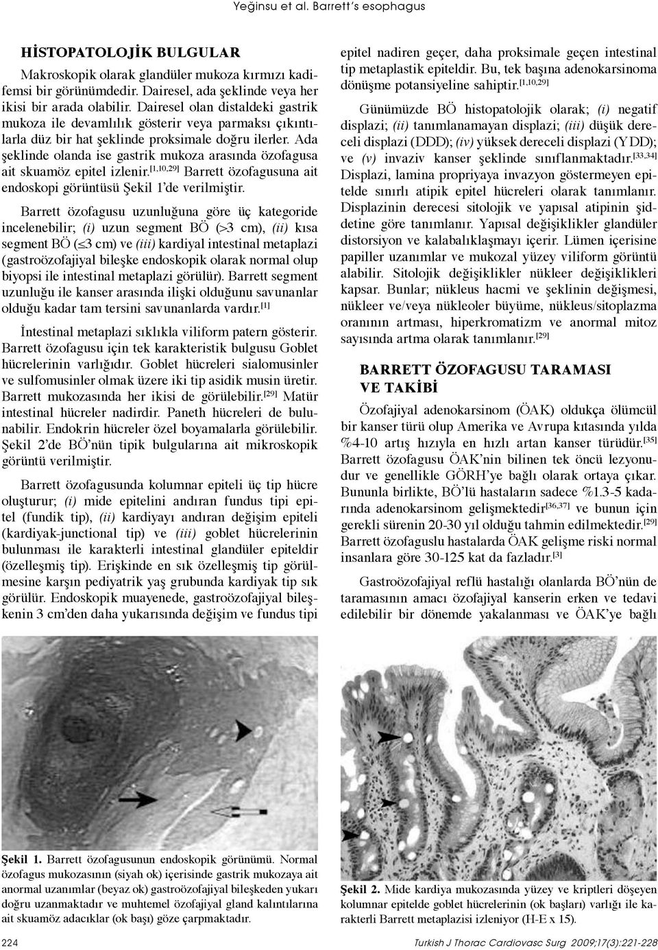 Ada şeklinde olanda ise gastrik mukoza arasında özofagusa ait skuamöz epitel izlenir. [1,10,29] Barrett özofagusuna ait endoskopi görüntüsü Şekil 1 de verilmiştir.