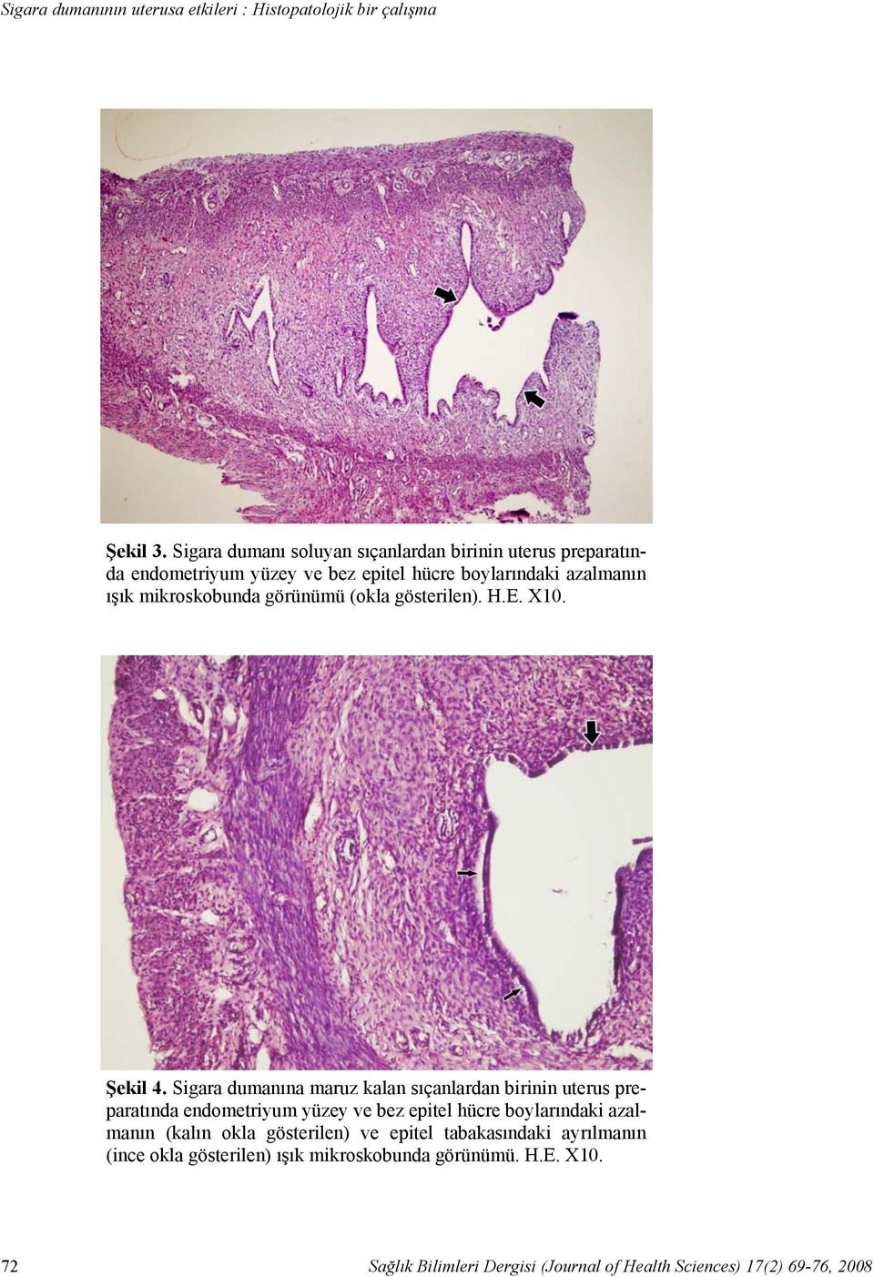 Sigara dumanı soluyan sıçanlardan birinin uterus preparatında endometriyum yüzey ve bez epitel hücre boylarındaki azalmanın ışık mikroskobunda görünümü