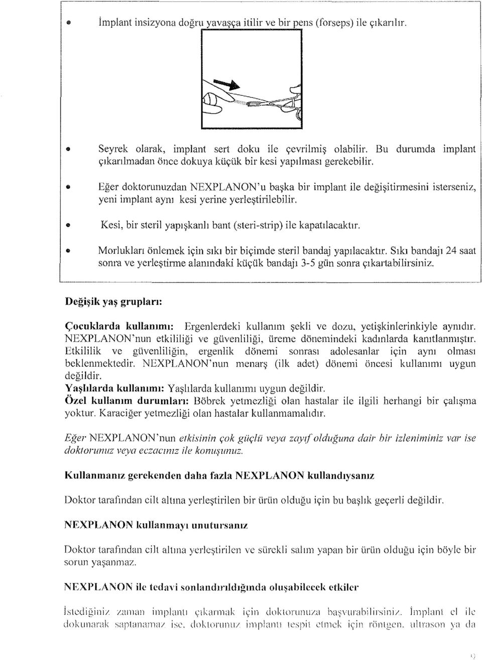 Eğer doktorunuzdan NEXPLANON'u başka bir implant ile değişitirmesini isterseniz, yeni implant aynı kesi yerine yerleştirilebilir. Kesi, bir steril yapışkanlı bant (steri-strip) ile kapatılacaktır.