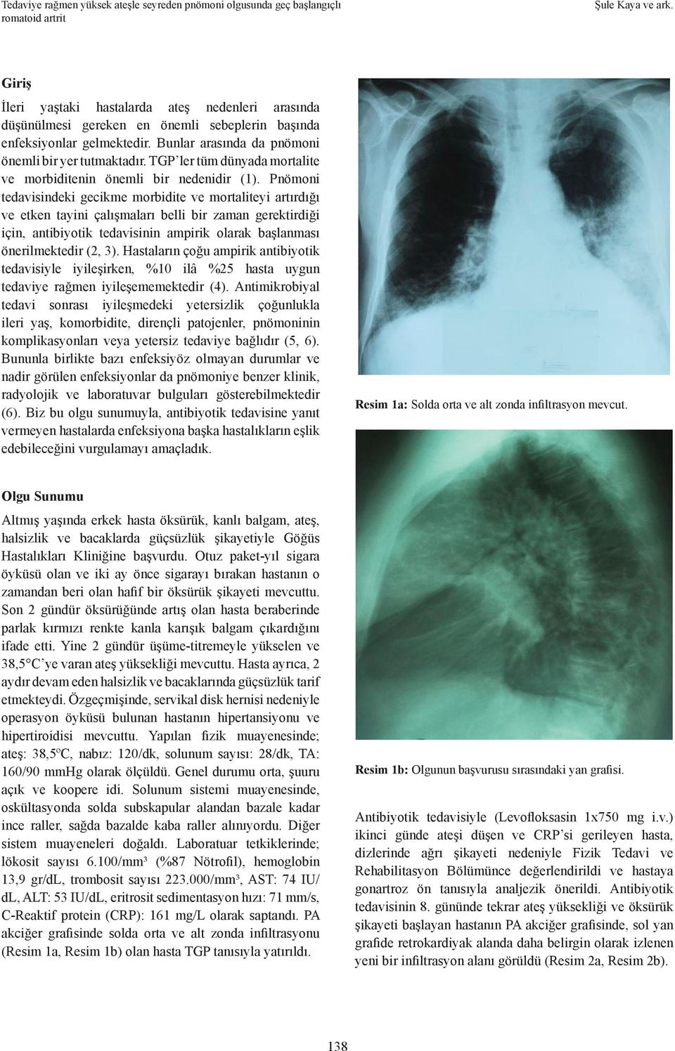 Pnömoni tedavisindeki gecikme morbidite ve mortaliteyi artırdığı ve etken tayini çalışmaları belli bir zaman gerektirdiği için, antibiyotik tedavisinin ampirik olarak başlanması önerilmektedir (2, 3).