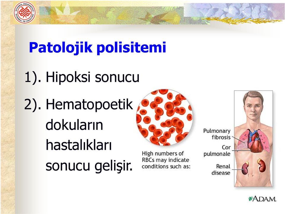 Hematopoetik dokuların