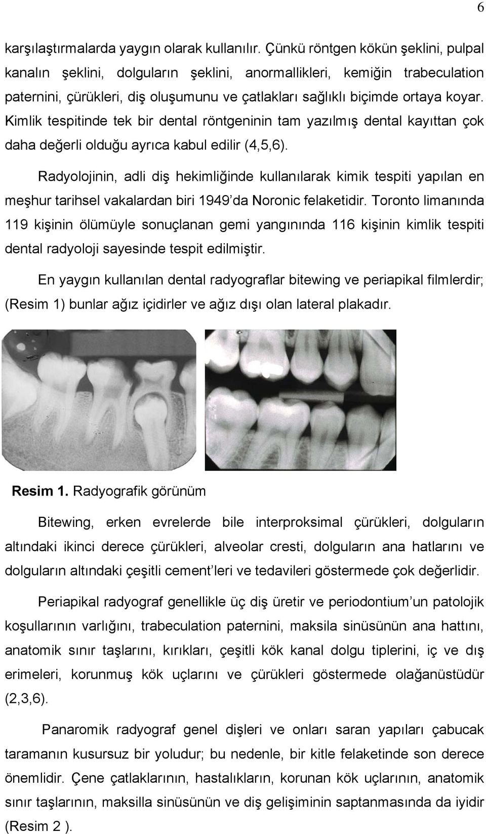 Kimlik tespitinde tek bir dental röntgeninin tam yazılmış dental kayıttan çok daha değerli olduğu ayrıca kabul edilir (4,5,6).