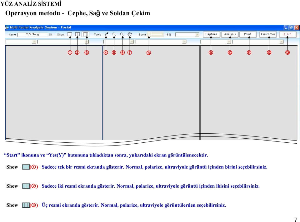 Normal, polarize, ultraviyole görüntü içinden birini seçebilirsiniz. Show (2) Sadece iki resmi ekranda gösterir.