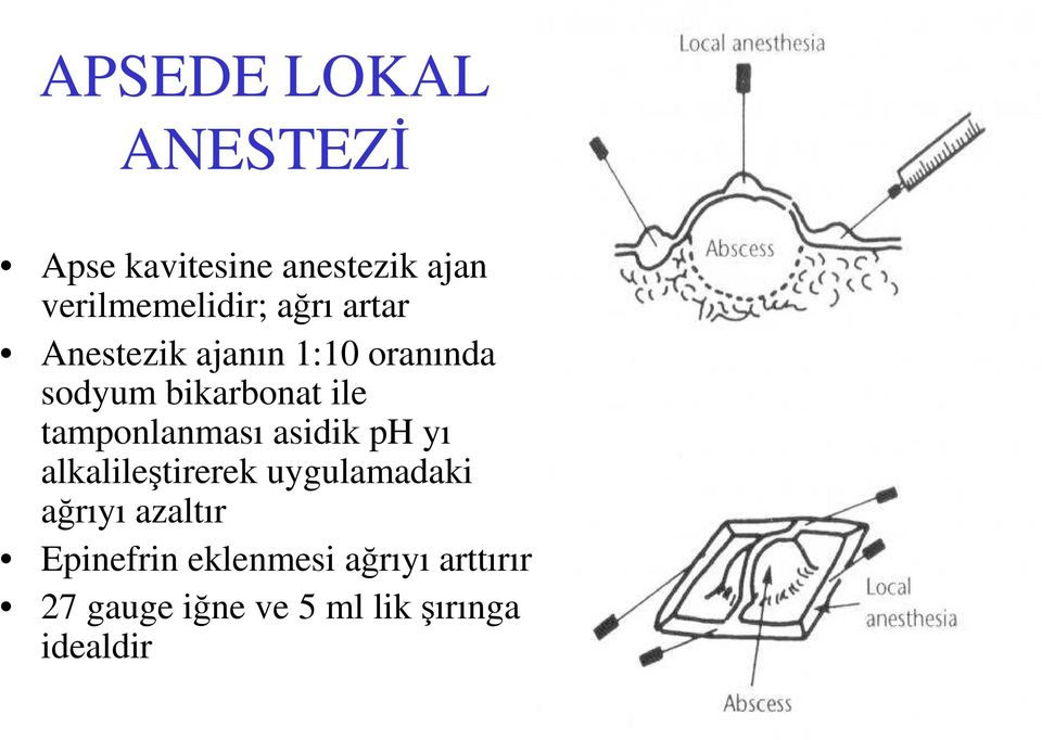 tamponlanması asidik ph yı alkalileştirerek uygulamadaki ağrıyı