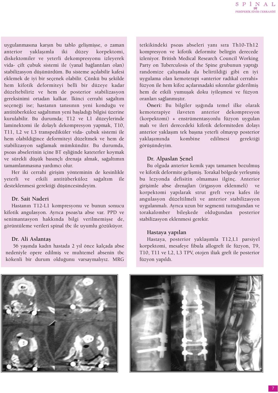 Çünkü bu şekilde hem kifotik deformiteyi belli bir düzeye kadar düzeltebiliriz ve hem de posterior stabilizasyon gereksinimi ortadan kalkar.