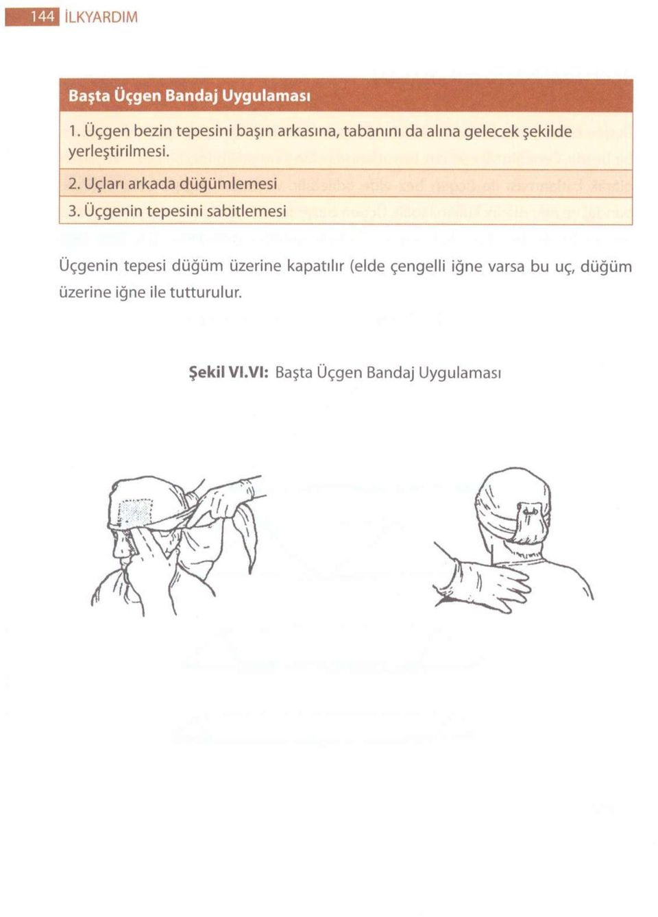 yerleştirilmesi. 2. Uçları arkada düğümlemesi 3.