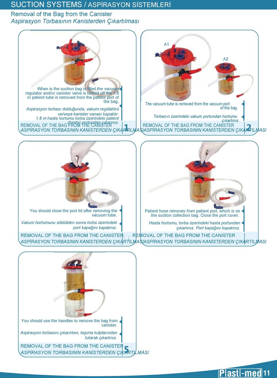 Aspirasyon torbası dolduğunda, vakum regülatörü ve/veya kanister vanası kapatılır. 1.8 m hasta hortumu torba üzerindeki patient Torban n üzerindeki vakum portundan hortumu (hasta) portundan çıkarınız.