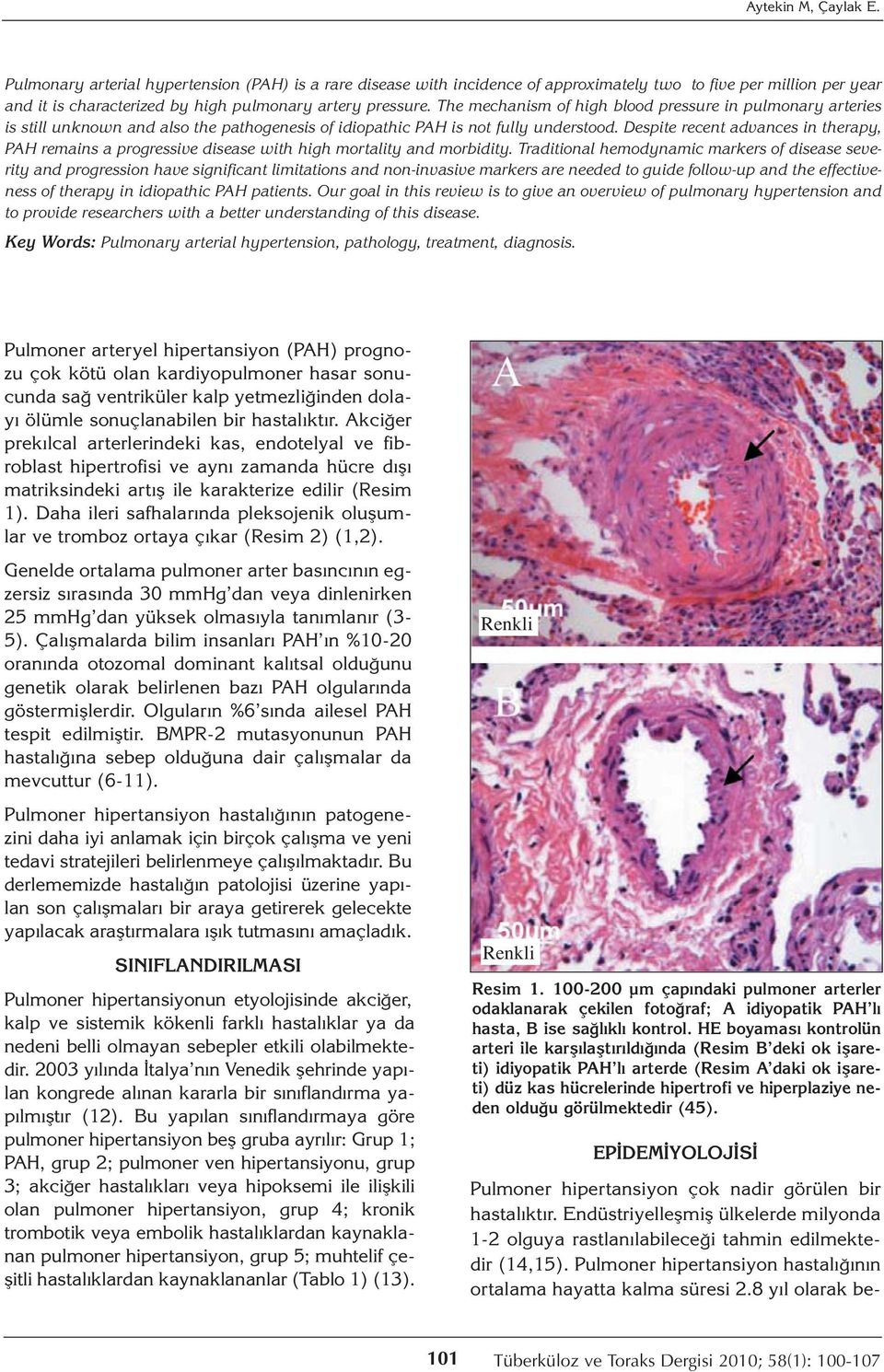 Despite recent advances in therapy, PAH remains a progressive disease with high mortality and morbidity.