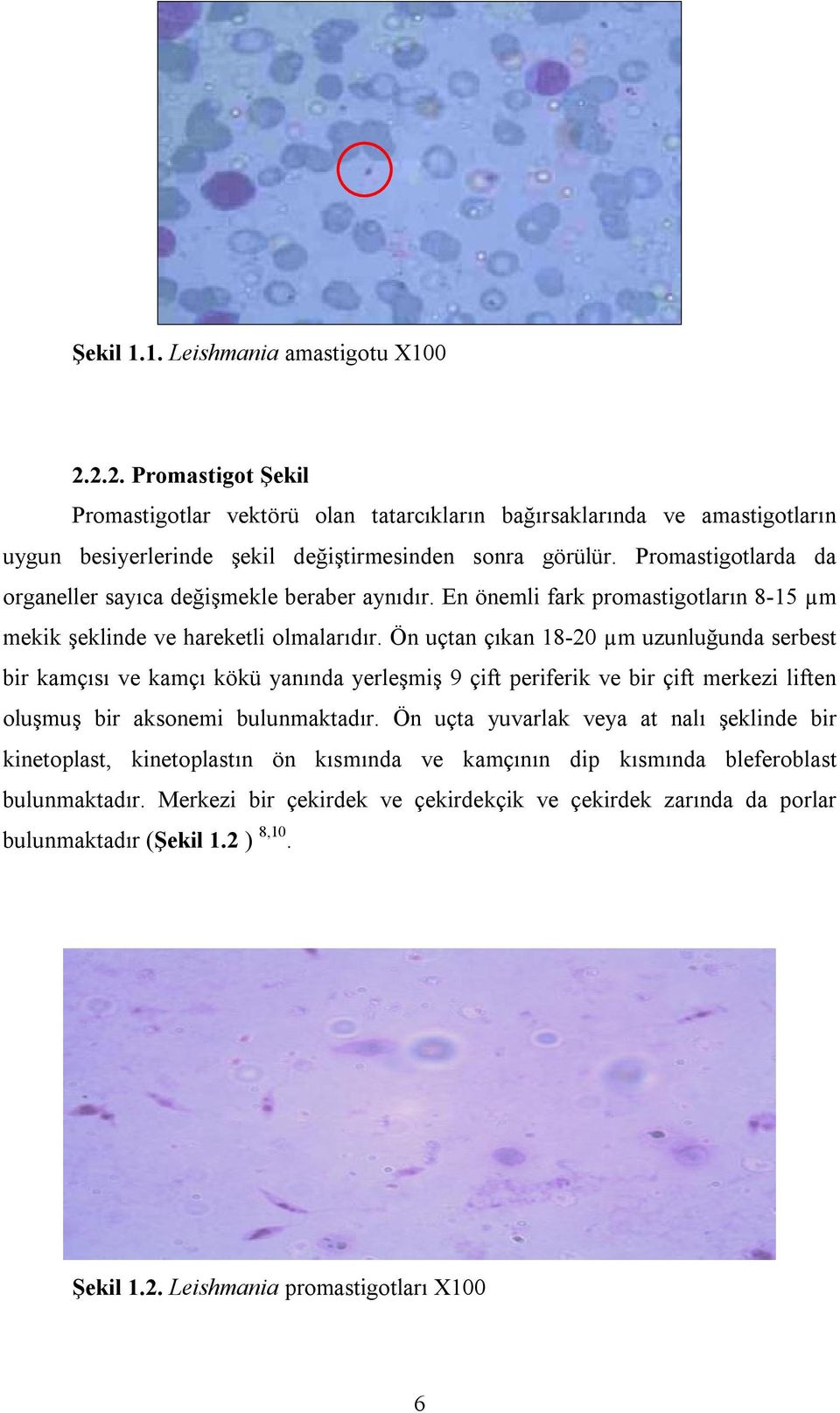 Ön uçtan çıkan 18-20 µm uzunluğunda serbest bir kamçısı ve kamçı kökü yanında yerleşmiş 9 çift periferik ve bir çift merkezi liften oluşmuş bir aksonemi bulunmaktadır.