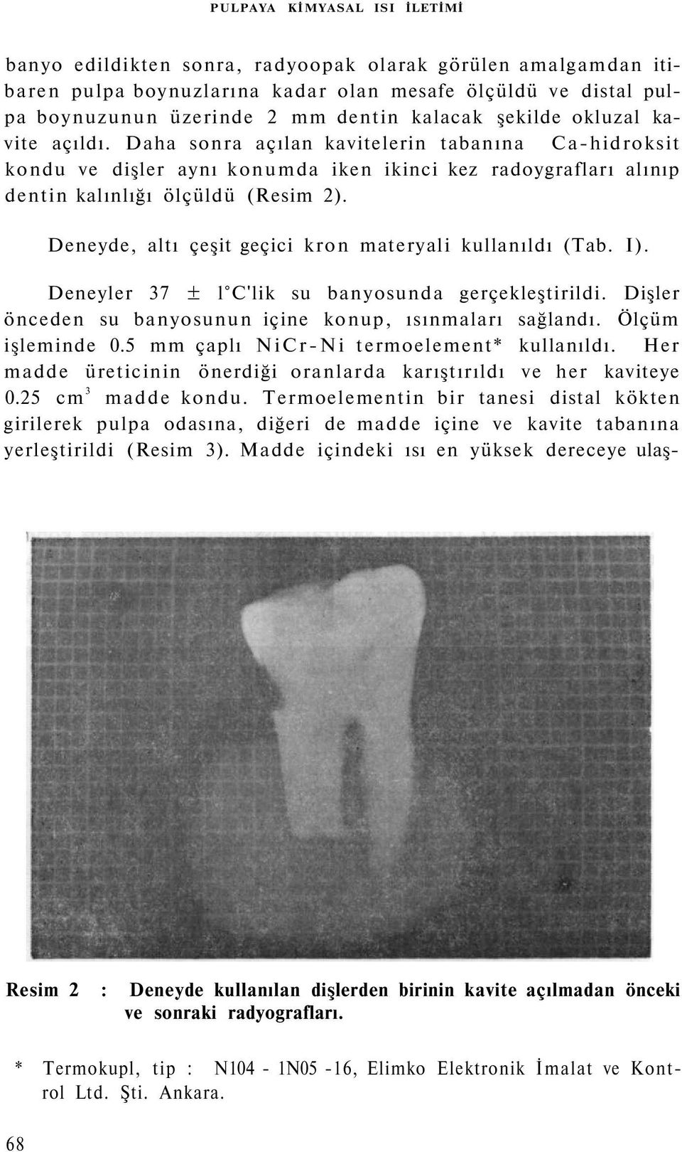 Deneyde, altı çeşit geçici kron materyali kullanıldı (Tab. I). Deneyler 37 ± l C'lik su banyosunda gerçekleştirildi. Dişler önceden su banyosunun içine konup, ısınmaları sağlandı. Ölçüm işleminde 0.