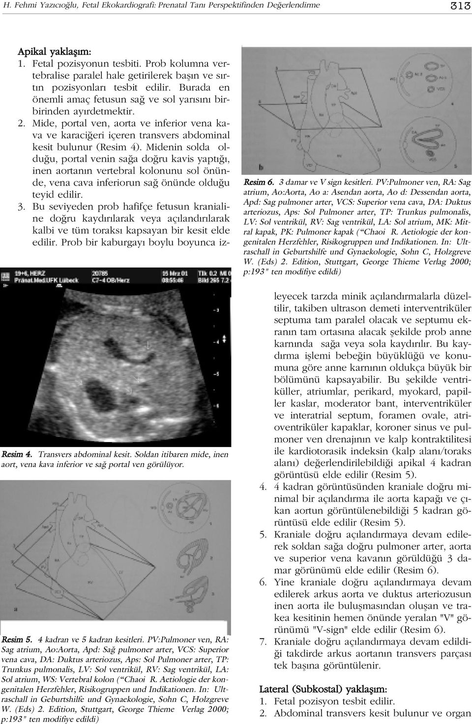 PV:Pulmoner ven, RA: Sag atrium, Ao:Aorta, Apd: Sa pulmoner arter, VCS: Superior vena cava, DA: Duktus arteriozus, Aps: Sol Pulmoner arter, TP: Trunkus pulmonalis, LV: Sol ventrikül, RV: Sag