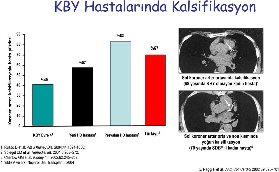 2004;44:1024-1030; 2. Spiegel DM et al. Hemodial Int. 2004;8:265 272; 3. Chertow GM et al. Kidney Int. 2002;62:245 252 4.