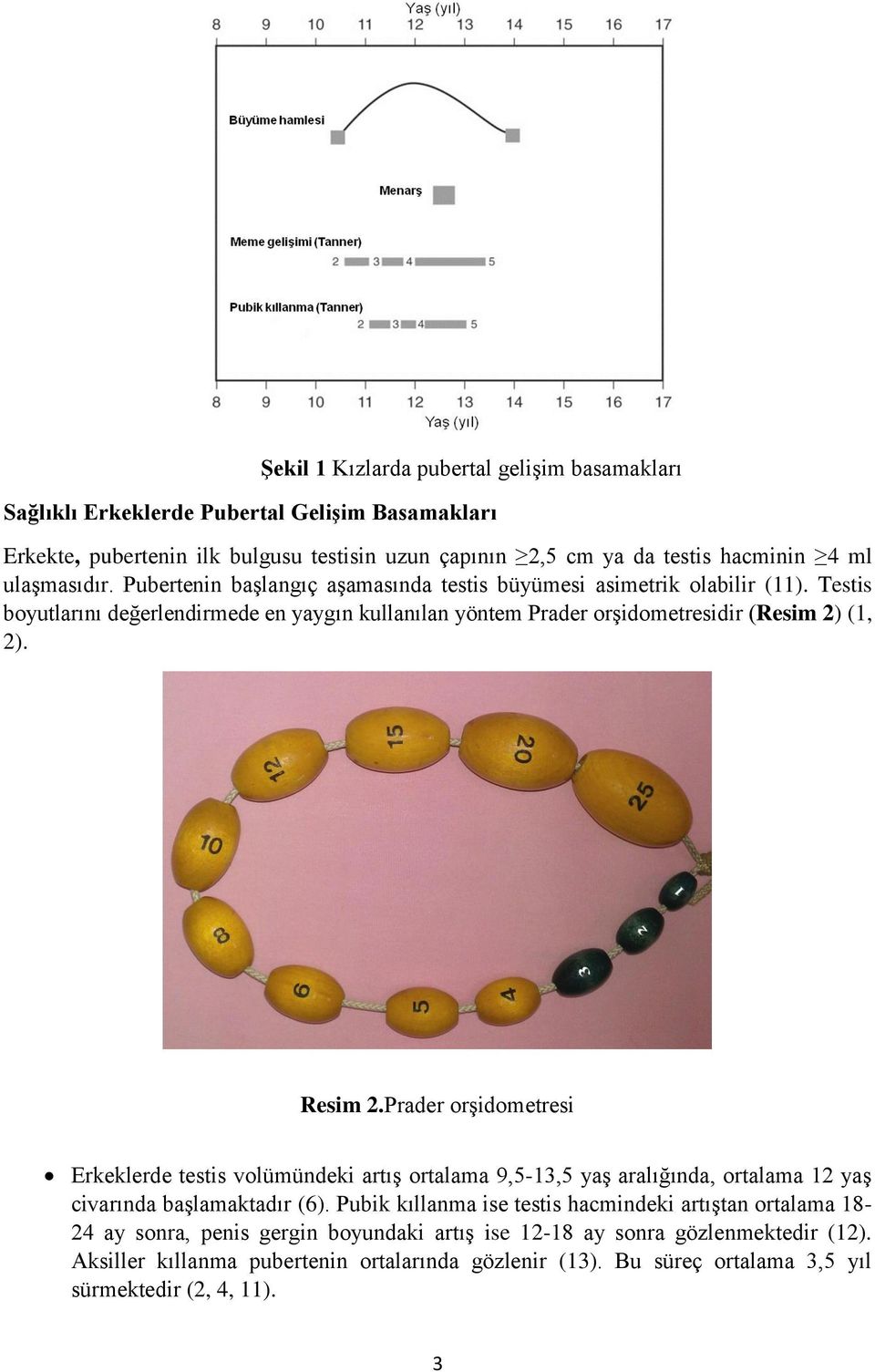 Resim 2.Prader orşidometresi Erkeklerde testis volümündeki artış ortalama 9,5-13,5 yaş aralığında, ortalama 12 yaş civarında başlamaktadır (6).